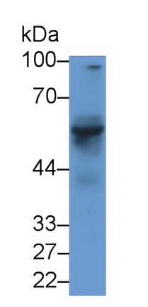 Monoclonal Antibody to Anti-Mullerian Hormone (AMH)