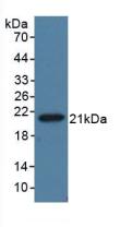 Monoclonal Antibody to Anti-Mullerian Hormone (AMH)