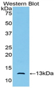 Monoclonal Antibody to Anti-Mullerian Hormone (AMH)