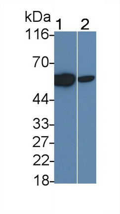 Monoclonal Antibody to Interleukin 2 Receptor Beta (IL2Rb)