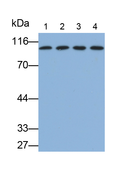 Monoclonal Antibody to Complement 1 Inhibitor (C1INH)