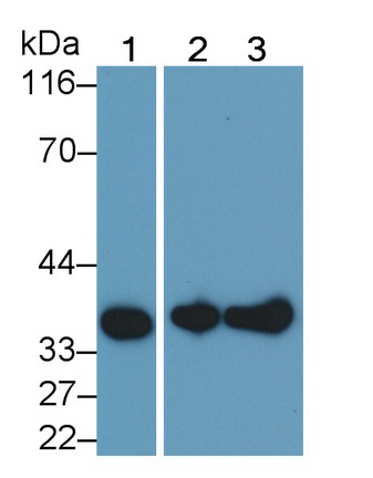 Monoclonal Antibody to Annexin V (ANXA5)