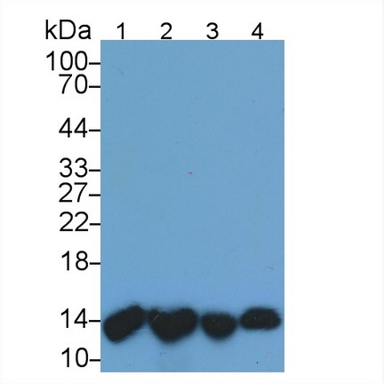 Monoclonal Antibody to Beta-2-Microglobulin (b2M)