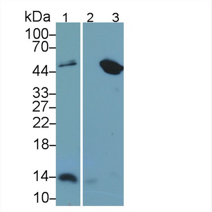 Monoclonal Antibody to Beta-2-Microglobulin (b2M)