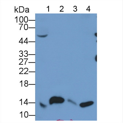 Monoclonal Antibody to Beta-2-Microglobulin (b2M)