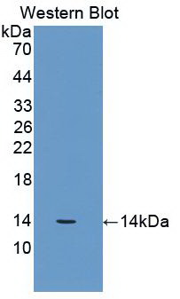 Monoclonal Antibody to Beta-2-Microglobulin (b2M)