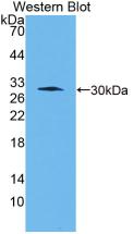 Monoclonal Antibody to Cathepsin K (CTSK)