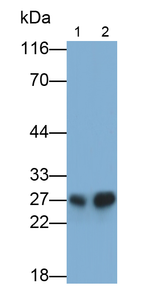 Monoclonal Antibody to Cathepsin K (CTSK)