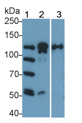 Monoclonal Antibody to Poly ADP Ribose Polymerase (PARP)