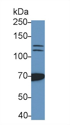 Monoclonal Antibody to Poly ADP Ribose Polymerase (PARP)