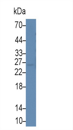 Monoclonal Antibody to Galectin 3 (GAL3)