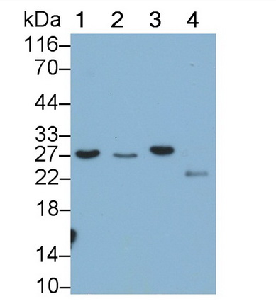 Monoclonal Antibody to Galectin 3 (GAL3)