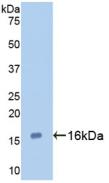 Monoclonal Antibody to Galectin 7 (GAL7)