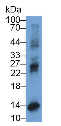 Monoclonal Antibody to Interferon Gamma Induced Protein 10kDa (IP10)