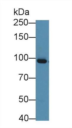 Monoclonal Antibody to Gelsolin (GSN)