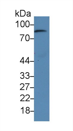 Monoclonal Antibody to Gelsolin (GSN)