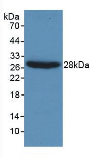 Monoclonal Antibody to Gelsolin (GSN)