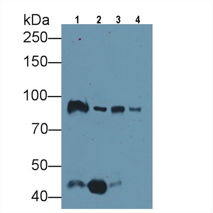 Monoclonal Antibody to Gelsolin (GSN)