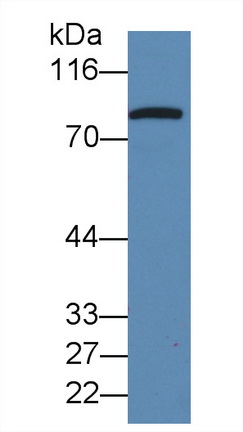 Monoclonal Antibody to Gelsolin (GSN)