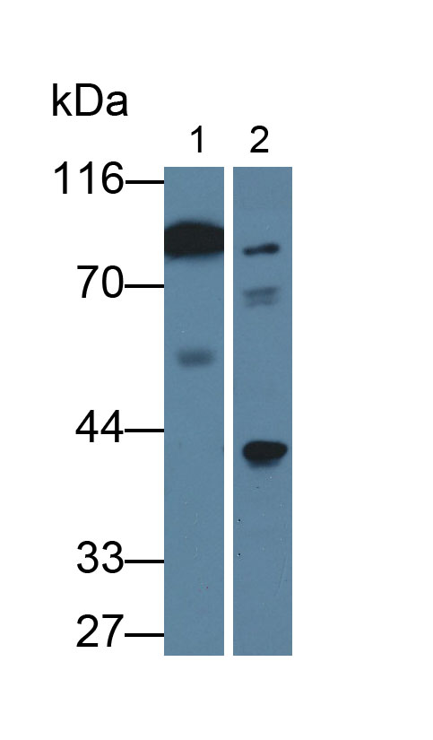 Monoclonal Antibody to Gelsolin (GSN)