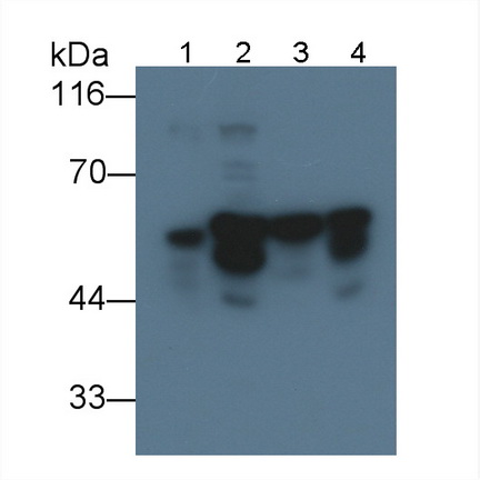 Monoclonal Antibody to Desmin (Des)