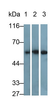 Monoclonal Antibody to Desmin (Des)