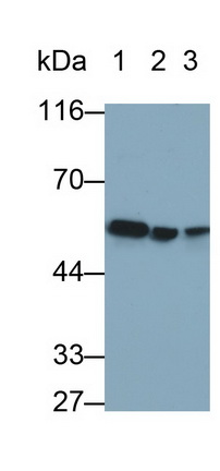 Monoclonal Antibody to Desmin (Des)