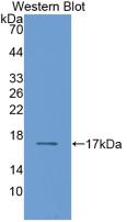 Monoclonal Antibody to Retinol Binding Protein 2, Cellular (RBP2)