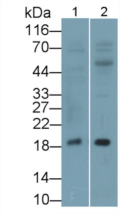 Monoclonal Antibody to Vasoactive Intestinal Peptide (VIP)