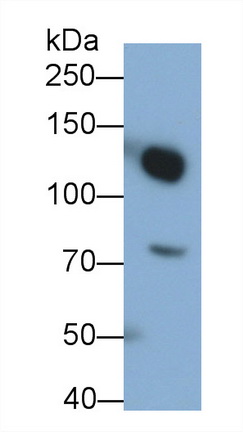 Monoclonal Antibody to Complement Component 3a (C3a)