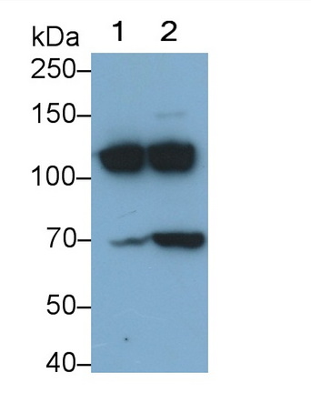 Monoclonal Antibody to Complement Component 3a (C3a)