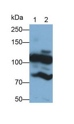 Monoclonal Antibody to Complement Component 3a (C3a)