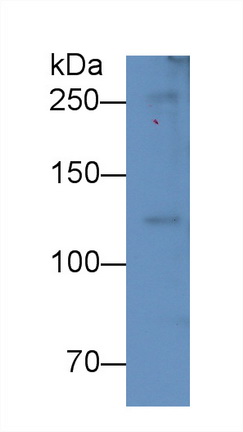 Monoclonal Antibody to Complement Component 5a (C5a)
