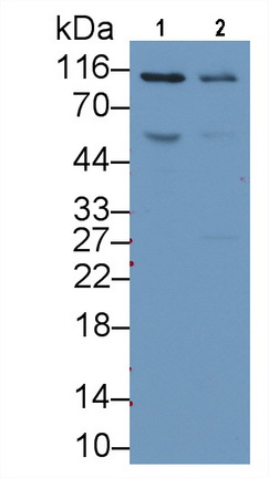 Monoclonal Antibody to Complement Component 5a (C5a)