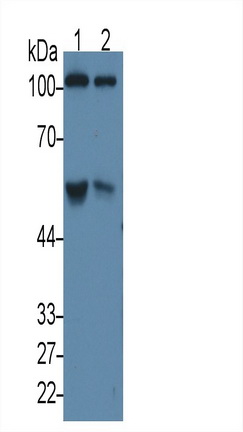 Monoclonal Antibody to Complement Component 5a (C5a)