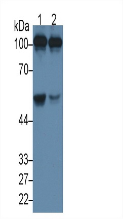 Monoclonal Antibody to Complement Component 5a (C5a)