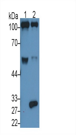 Monoclonal Antibody to Complement Component 5a (C5a)