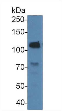 Monoclonal Antibody to Complement Component 5a (C5a)