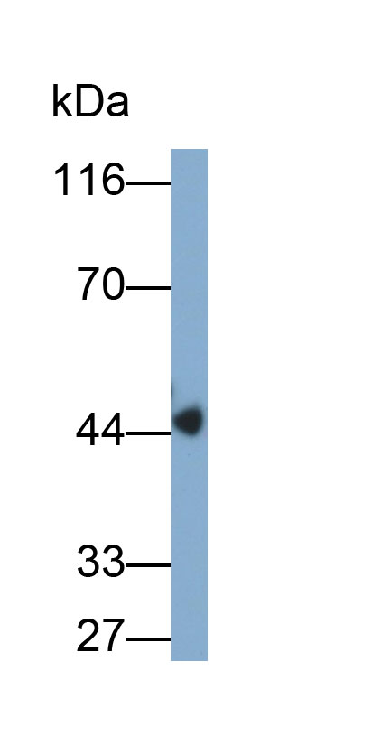 Monoclonal Antibody to Tissue Factor Pathway Inhibitor (TFPI)