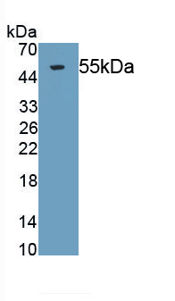 Monoclonal Antibody to Tissue Factor Pathway Inhibitor (TFPI)