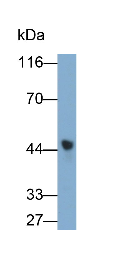 Monoclonal Antibody to Tissue Factor Pathway Inhibitor (TFPI)