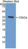 Monoclonal Antibody to Tissue Factor Pathway Inhibitor (TFPI)