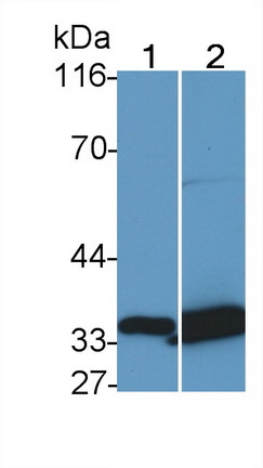 Monoclonal Antibody to Tissue Factor Pathway Inhibitor (TFPI)