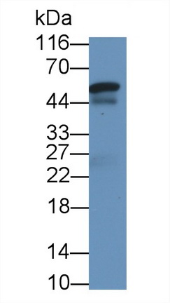 Monoclonal Antibody to Sex Hormone Binding Globulin (SHBG)