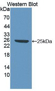 Monoclonal Antibody to High Mobility Group Protein 1 (HMGB1)