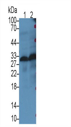 Monoclonal Antibody to Myelin Oligodendrocyte Glycoprotein (MOG)