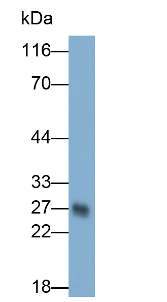 MAA421Hu22.jpg