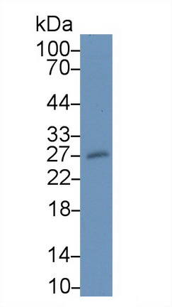 Monoclonal Antibody to Myelin Oligodendrocyte Glycoprotein (MOG)