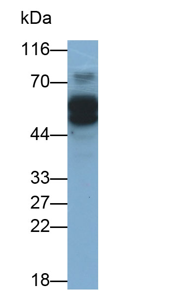 Monoclonal Antibody to Estrogen Receptor Beta (ERb)