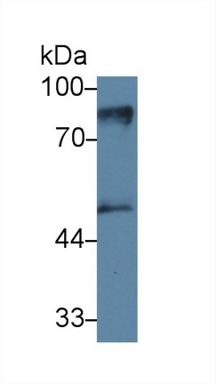 Monoclonal Antibody to Protein Kinase C Epsilon (PKCe)